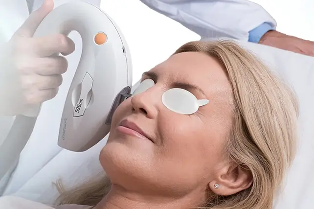 Photo of IPL for Dry Eye Treatment